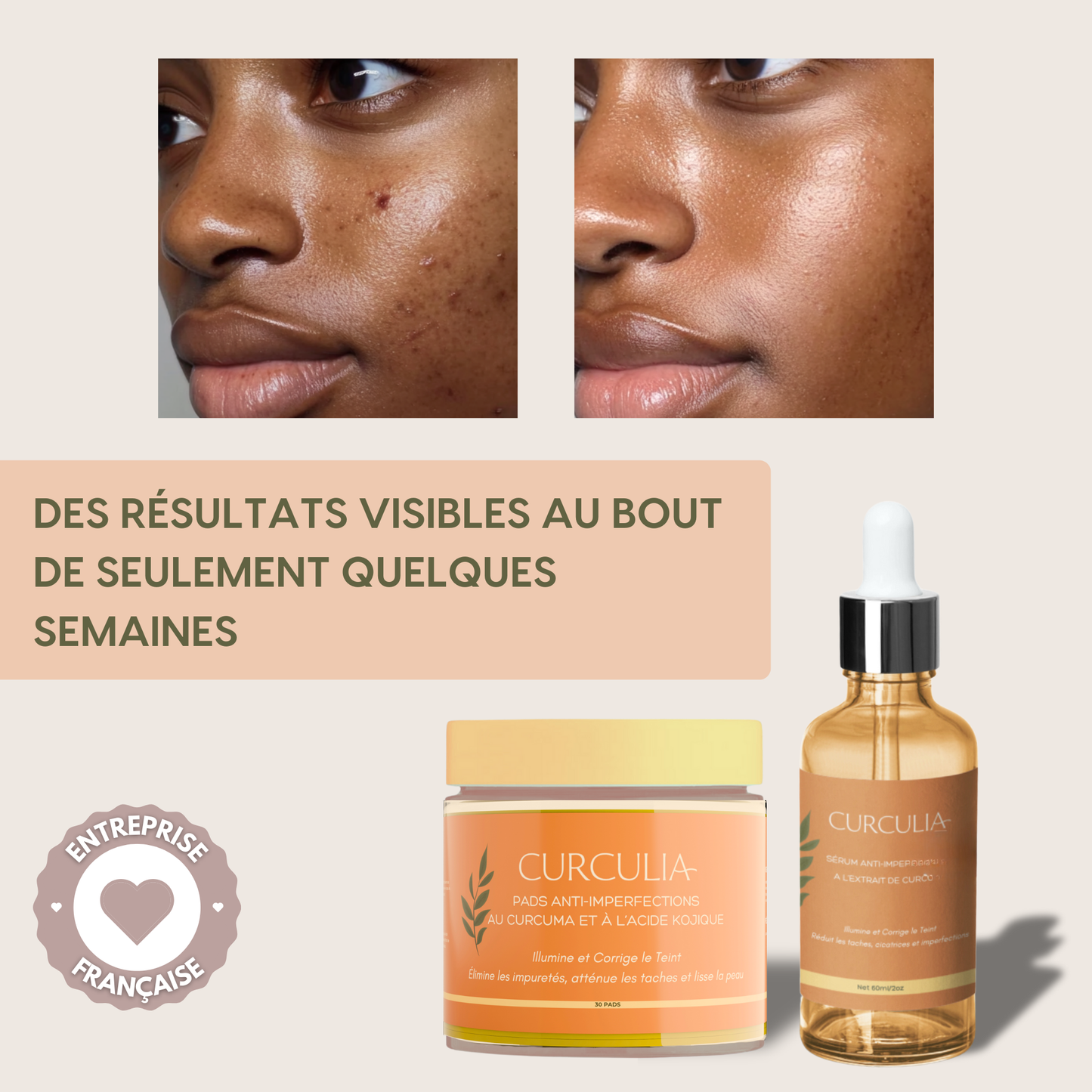Routine Anti-Imperfections 4 en 1