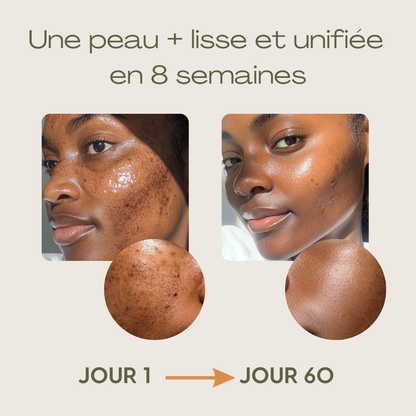 Routine Anti-Imperfections 4 en 1