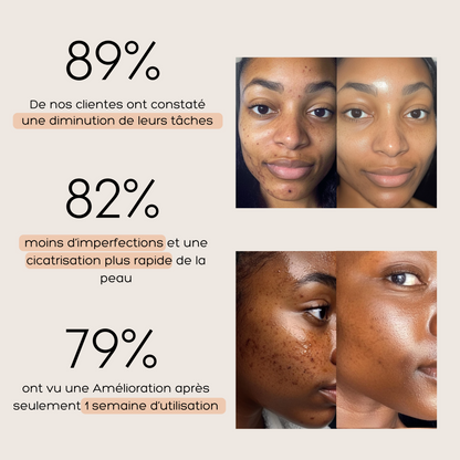 Routine Anti-Imperfections 4 en 1