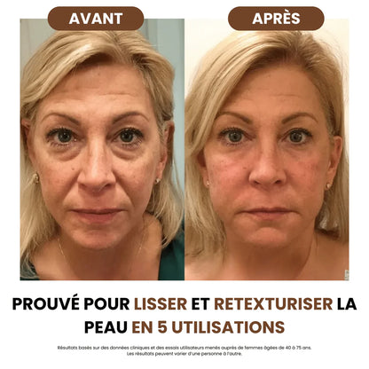 PureLift® - Brosse de Drainage Lymphatique