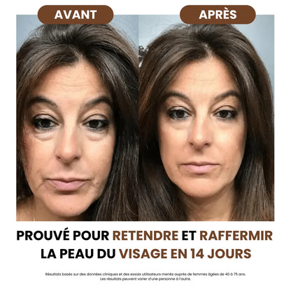 PureLift® - Brosse de Drainage Lymphatique